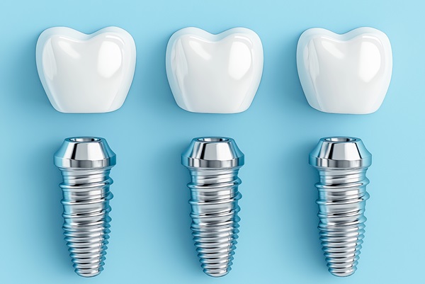 What Are Small Dental Implants?