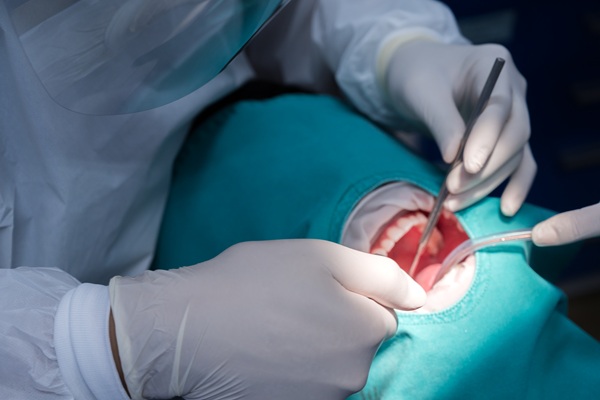 What To Expect When Consulting An Oral Surgeon