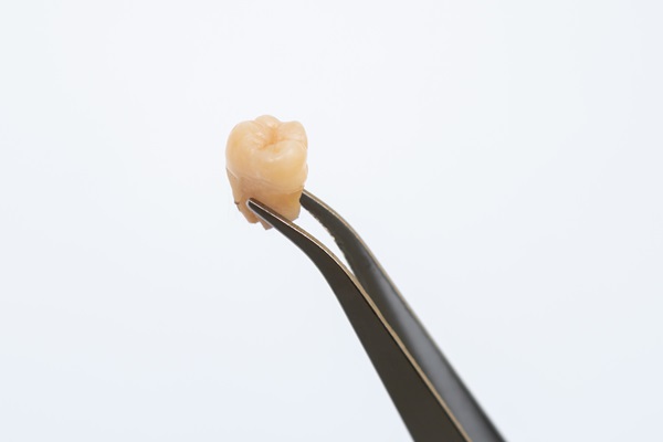 Understanding Wisdom Teeth Removal: Benefits And Risks